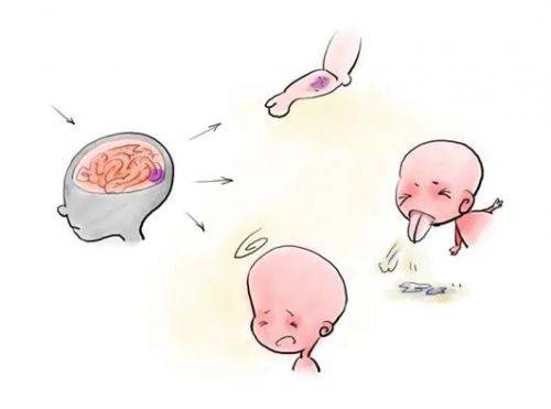脑损伤概述及其最佳生物标志物