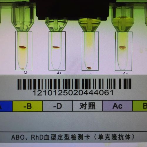 亚型献血者的血液如何输注？