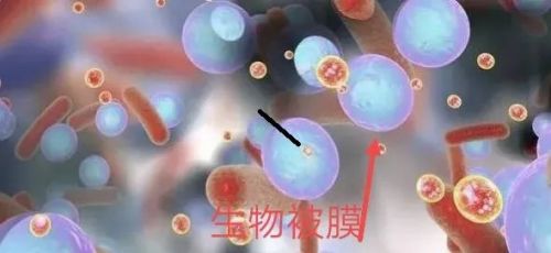 微生物室“最”难啃的硬骨头——定植菌or致病菌的决择！