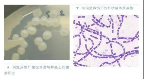 警惕！山东一名14岁学生感染炭疽后死亡，这些知识你应该了解 ...
