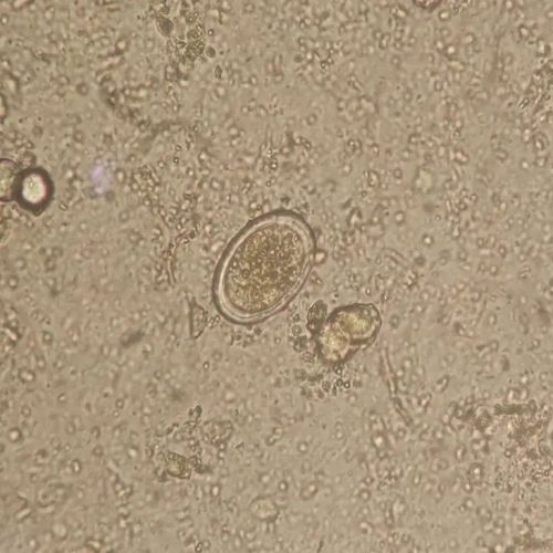 昨日“虫”现-在检验科养钩虫是一种什么样的体验？