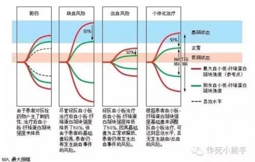 血栓弹力图，究竟能“弹”什么？丨知识星球