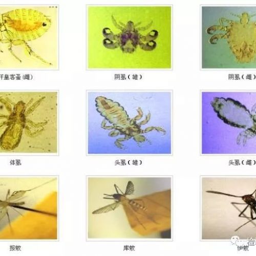 检验图谱 | 寄生虫汇总，多图慎入！