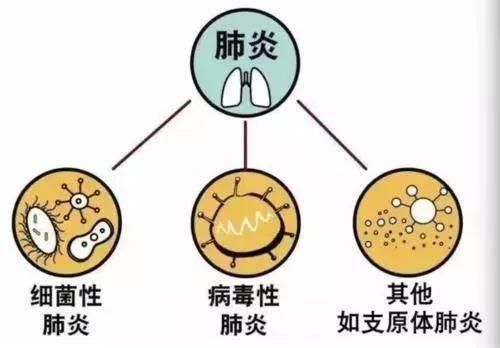 肺炎检测项目介绍