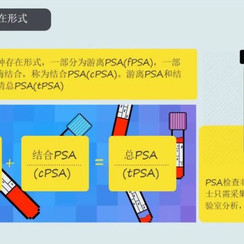 关于前列腺癌，PSA、PAP如何表达？