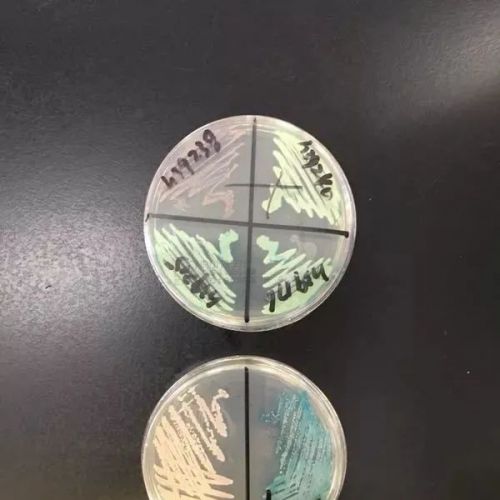 从细节入手，检验科如何节约试剂、节省成本？