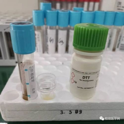 D-二聚体升高这么多，幕后推手竟藏在......