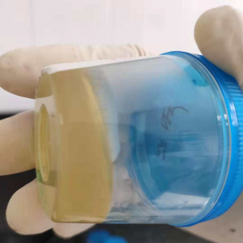 患者规范取的尿液，怎么放了 5 分钟竟凝结成了果冻 ？！