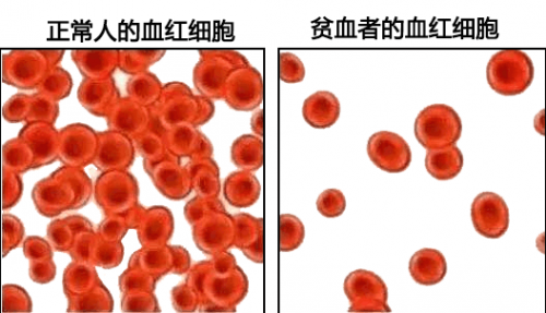 血常规检查能查出什么？