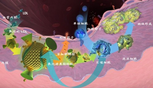 检验项目 | 氧化型低密度脂蛋白