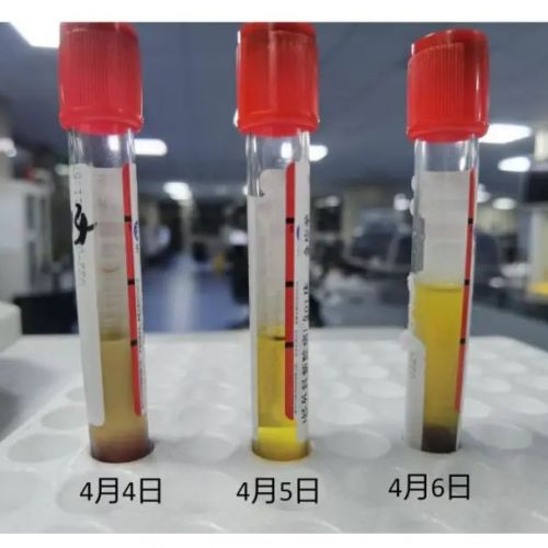 当检验结果与临床不符，这4个案例告诉你该怎么做