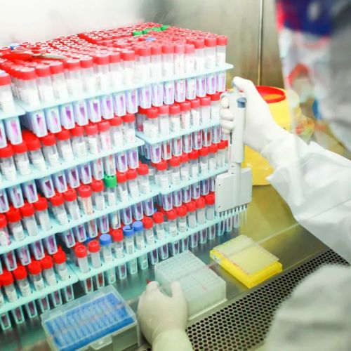 纾解疫情忧 惠济患者困 —— 走进贵州航天医院中心实验室
