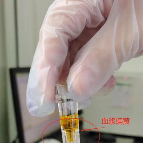 血常规检验经验分享——有趣的散点图