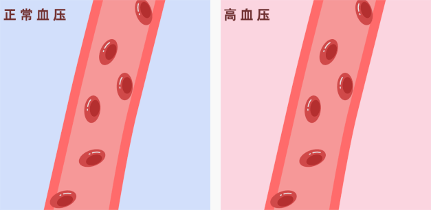 男女体检中，排名前10的异常指标被统计“出炉”！这些健康“雷区”，大家踩过几个？ ...