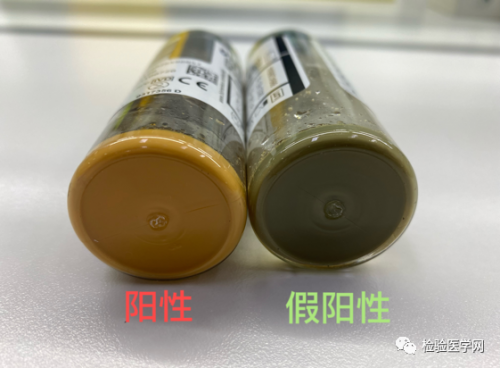 血培养报阳，却不见细菌？究竟是何原因导致？