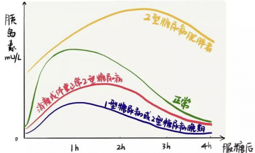 关于糖耐量试验+胰岛素C肽释放试验，这八个问题必须要看