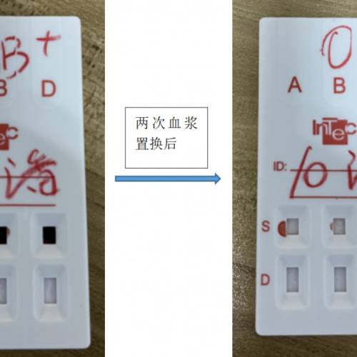 让我惊出一身冷汗的冷凝集标本