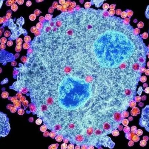 CD4和CD4/CD8比值的意义及正常值