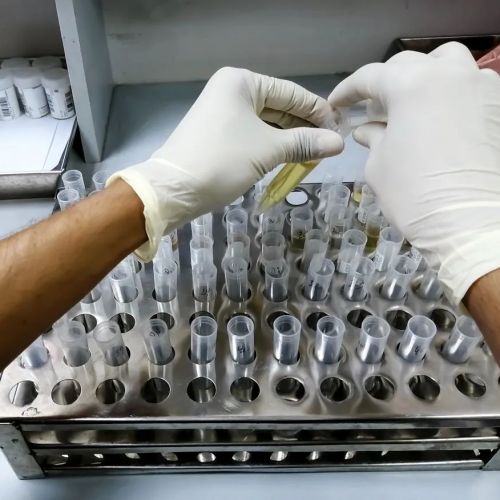 让专家都“看不懂”的尿液化验单，引人深思