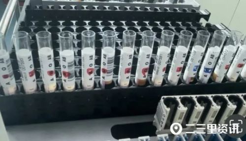 全球罕见，血站检验人接连发现“黄金血型”！