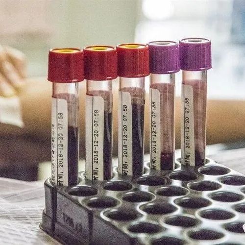 医生动不动就抽血，抽血到底能干啥？抽出来的血去哪了？