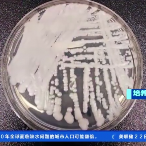 “超级真菌”要来了？遍布美国一半以上州，传播速度惊人！ ...