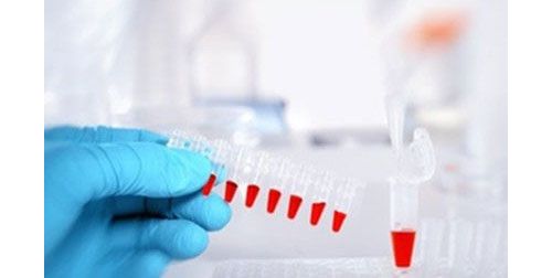 肝功能正常，纤维蛋白原却是危急值，这是为何？