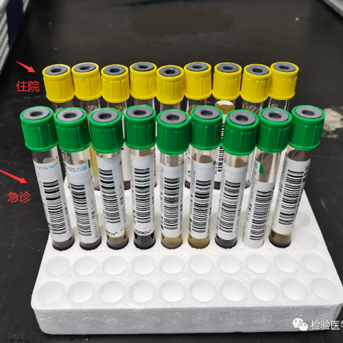 “准确”的检验结果就一定是临床需要的吗？其实不然...