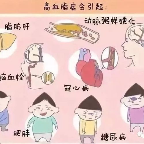 脂代谢及高脂蛋白血症