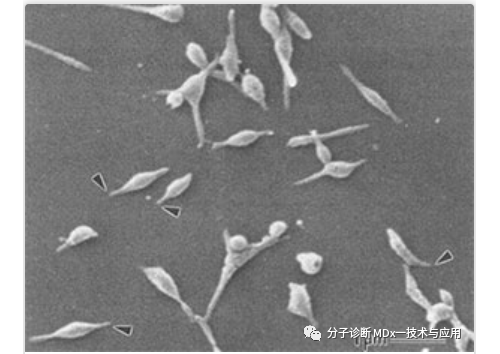 肺炎支原体感染及其分子检测