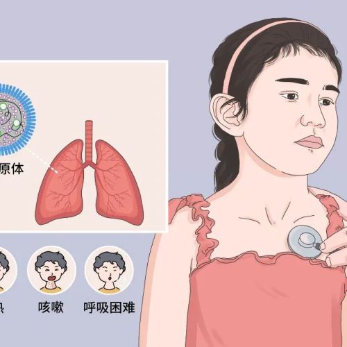 流感、感冒、支原体肺炎有什么区别？如何区分三者？