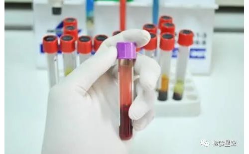 交叉配血试验方法学对比
