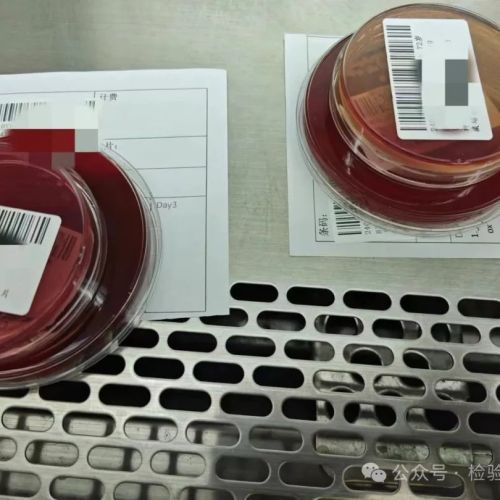 来自检验科的神秘小纸条：微生物实验室里……
