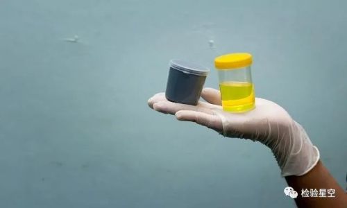急诊检验项目有哪些？
