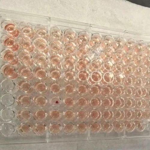 广东一检验科发现1例“钻石血”，稀有度超“熊猫血”！