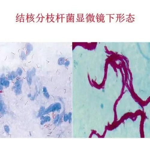 结核分枝杆菌的简介