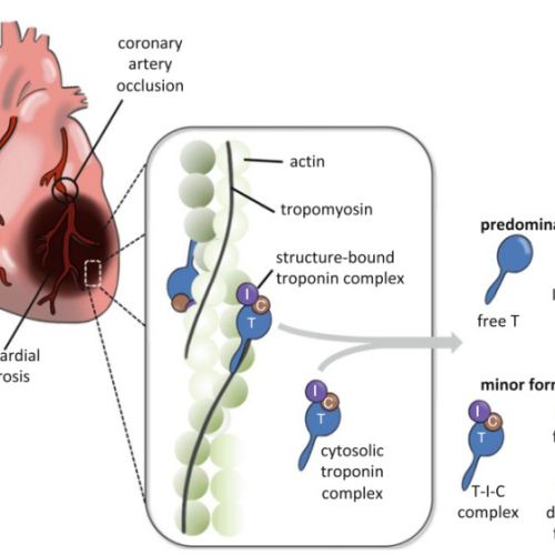 一文读懂——肌钙蛋白的临床意义