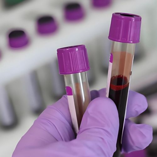 中疾控提醒：别光盯着流感了，这种病毒也高发！