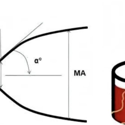 血栓弹力图到底是什么？