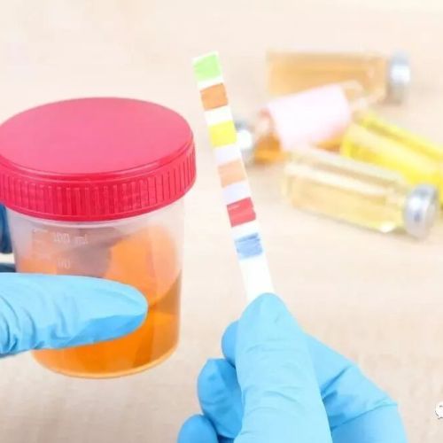 自相矛盾的尿常规检测结果？