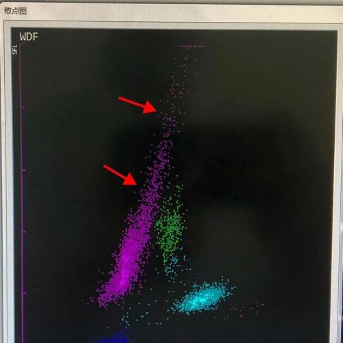 不提示≠不作为：面对不典型恙虫病，检验人为何选择"等等看"？ ...